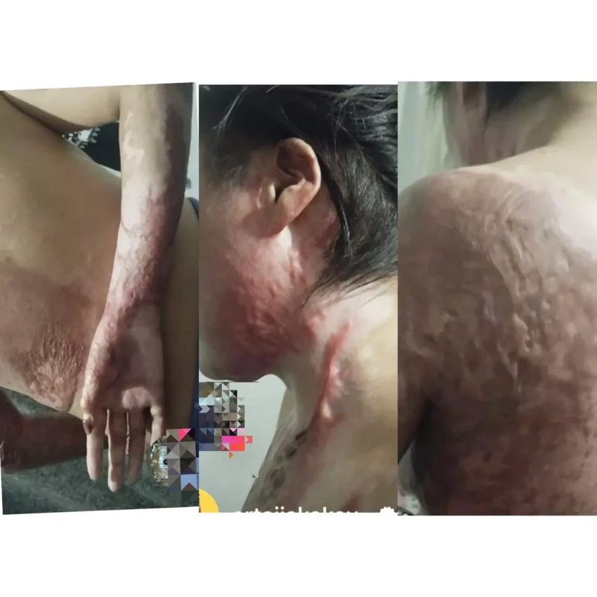 Муж облил жену бензином и поджег ее: Институт Омбудсмена рассказал подробности трагедии